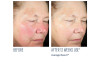 Even Intensive Skin Tone Correcting Serum