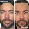 Omnilux Men Red Light Mask