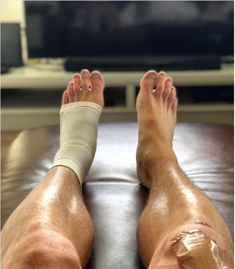 OS1st DS6 Night Time PF Treatment Sleeve - On Track & Field Inc