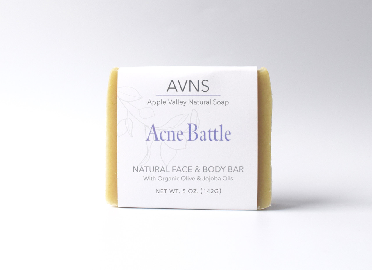 Acne Soap, Acne Battle Bar, Natural Soap For Acne