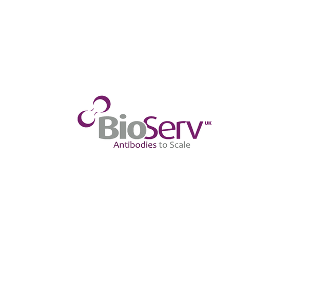 SARS-CoV-2 (2019-nCoV) Nucleoprotein / NP Antibody, Rabbit MAb