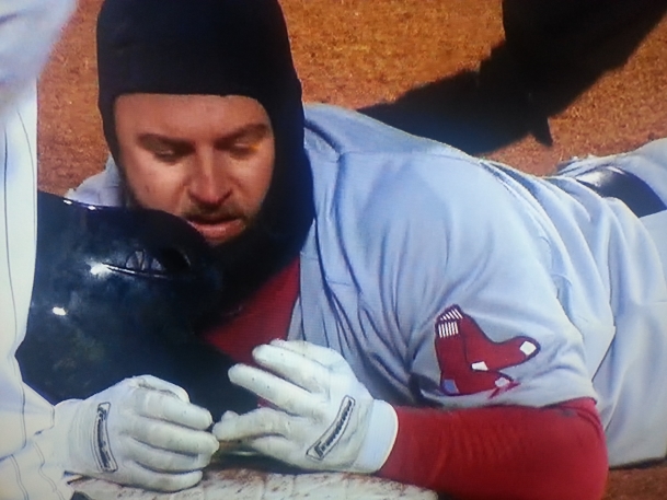 Baseball players receive little instruction in sliding