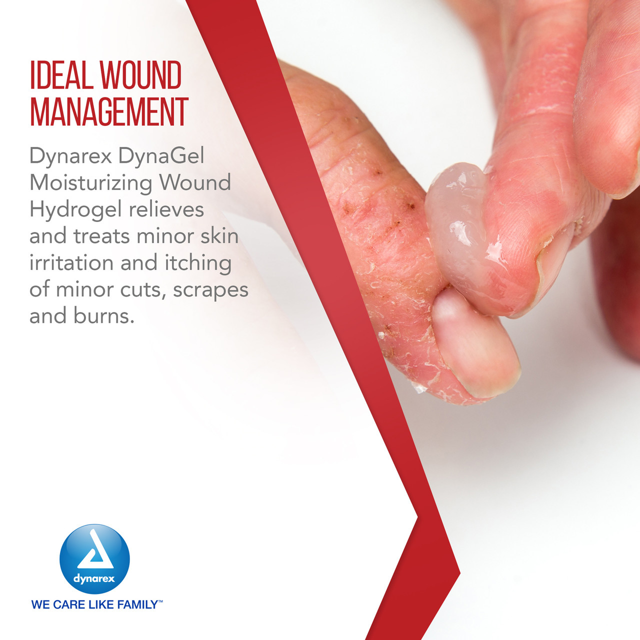 DYNAGEL MOISTURIZING WOUND HYDROGEL, 3oz.