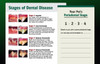 Stages of Dental Disease 2 Up (Doctor Hand Out)