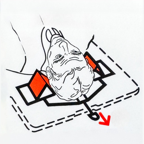 The image is a close-up of an instructional diagram from the Ambu Head Wedge cervical immobilization device. It illustrates the correct placement of the head within the device, emphasizing the positioning of red blocks around the head for secure immobilization. A red arrow points downwards, directing the user to properly align the head along the central axis of the device. This detailed diagram serves as a visual guide for emergency medical personnel to ensure accurate and safe usage of the immobilization device.