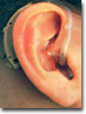 The Ultimate Guide to Keeping Your Hearing Aids Clean and Clear