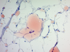 Oil Red O Histology Stain Kit (For Fat), 100 Slides