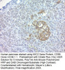 CD99 / MIC2 (Ewing's Sarcoma Marker); Clone HO36-1.1, Concentrate, 0.1 mL