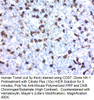 CD57 / B3GAT1 (Natural Killer Cell Marker); Clone NK-1, Concentrate, 0.1 mL