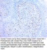 CD57 / B3GAT1 (Natural Killer Cell Marker); Clone NK-1, Concentrate, 0.1 mL