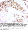 Cyclin D1 (G1-Cyclin & Mantle Cell Lymphoma Marker); Clone CCND1/3370, Concentrate, 0.1 mL