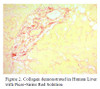 Picro-Sirius Red Solution Histology Stain, 1000 mL