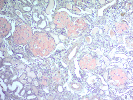 Amyloid Histology Stain Kit (Congo Red)