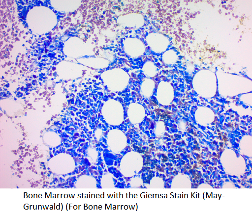 Giemsa Microbiology Hematology Stain Kit May Grunwald 100 Slides giemsa-microbiology-hematology-stain-kit-may-grunwald-100-slides