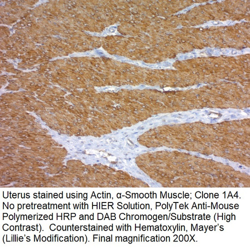 Actin, Alpha-Smooth Muscle; Clone 1A4 (Concentrate), 1mL