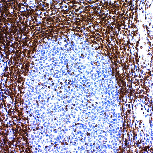 Bcl-2; Clone 124 (Ready-To-Use), 2mL