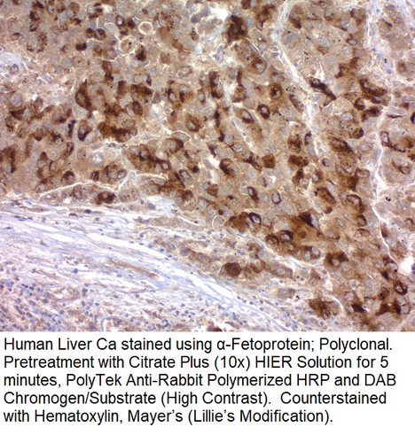 Alpha-1-Fetoprotein (AFP); Polyclonal (Ready-To-Use), 2mL