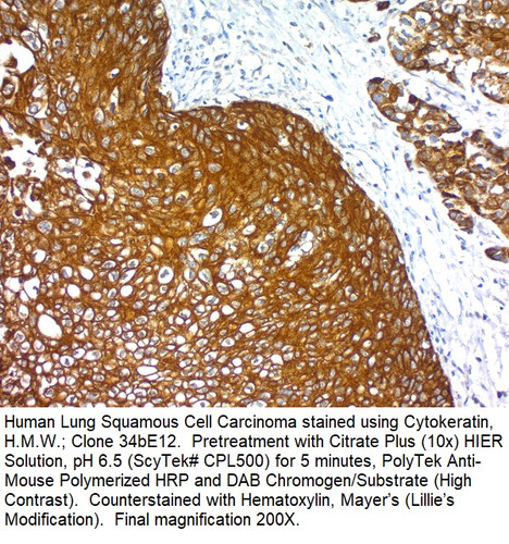 Cytokeratin, High Molecular Weight; Clone 34bE12 (Ready-To-Use), 2mL