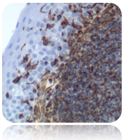 Vimentin; Clone SP20 (Ready-To-Use), 2mL
