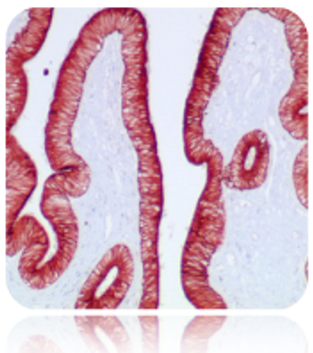 AEC Chromogen/Substrate HRP Antibody Conjugation Stain Kit, 515mL