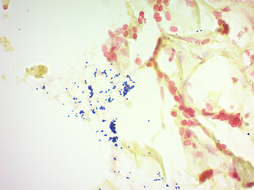 Gram Microbiology/Histology Stain Kit (Modified Brown & Brenn), 500mL