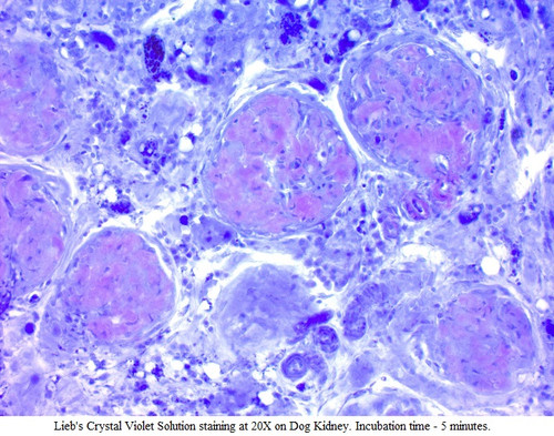 Lieb's Crystal Violet for Amyloid (0.5%) Stain Kit, 250mL Lieb's Crystal Violet for Amyloid (0.5%) Stain Kit, 250mL