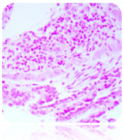 Nuclear Fast Red Solution (Enhanced Stability) Nuclear Stain, 125mL