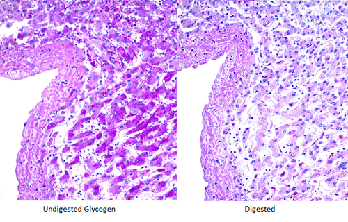 Periodic Acid Schiff (PAS) Diastase Histology Stain Kit