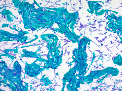 Periodic Acid Schiff (PAS) for Fungus Microbiology/Histology Stain Kit