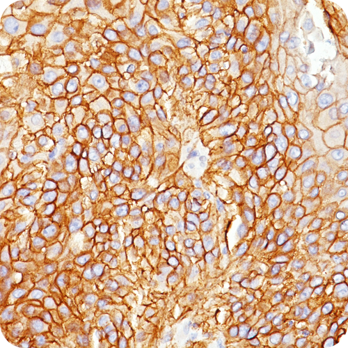 EGFR (Epidermal Growth Factor Receptor); Clone GFR450 (Concentrate), 0.1mL