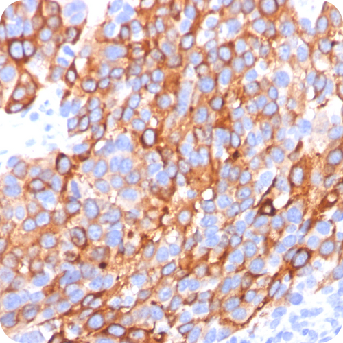 MART-1 / Melan-A /mLANA (Melanoma Marker); Clone A103, M2-7C10 & M2-9E3 (Concentrate), 0.5mL