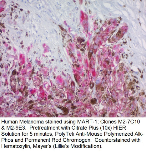 MART-1 / Melan-A /mLANA (Melanoma Marker); Clone M2-7C10 & M2-9E3 (Concentrate), 1mL