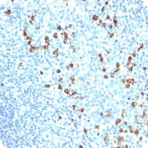 IgM (Immunoglobulin Mu Heavy Chain) (B-Cell Marker); Clone IM260 (Concentrate), 0.1mL