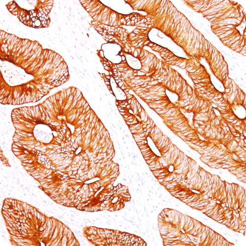 Cytokeratin 8 (KRT8); Clone K8/383 (Concentrate), 0.5mL