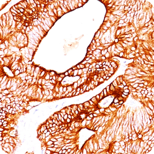 Cytokeratin 8 (KRT8); Clone TS1 (Concentrate), 0.5mL