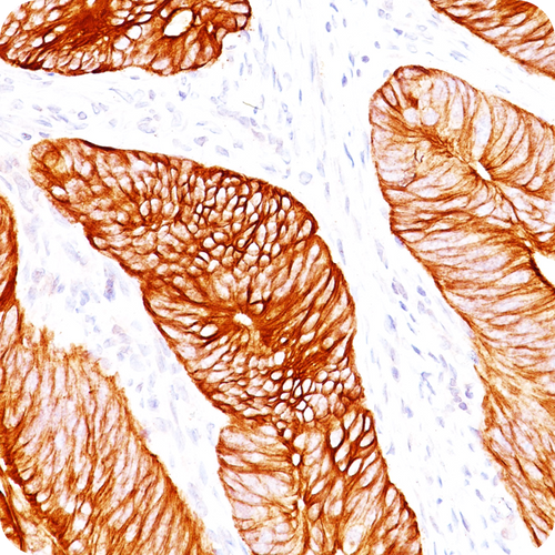 Cytokeratin 8 (KRT8); Clone H1 & TS1 (Concentrate), 0.5mL