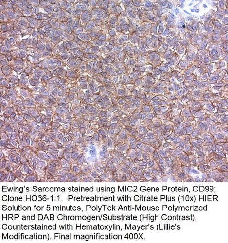 CD99 / MIC2 (Ewing's Sarcoma Marker); Clone HO36-1.1 (Concentrate), 0.5mL