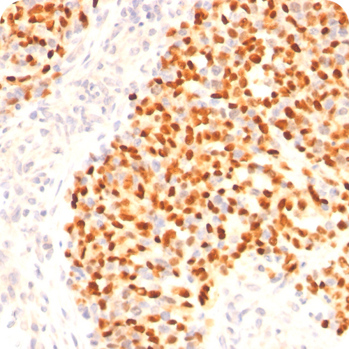 Myogenin (Skeletal Muscle Marker); Clone F5D (Concentrate), 0.5mL