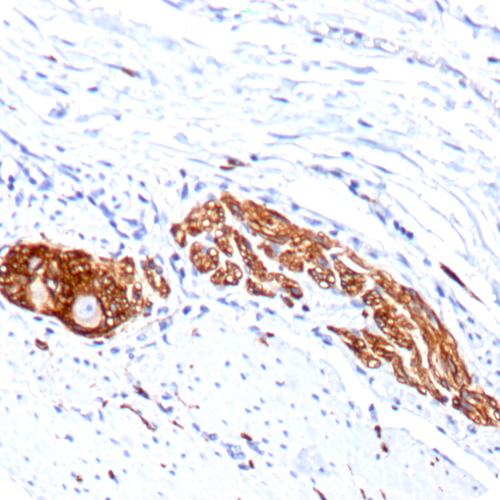 CD56 / NCAM1 / NKH1 (Neuronal Cell Marker); Clone 123C3.D5 & 123A8 (Concentrate), 0.5mL