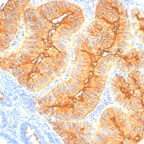 TAG-72 (Tumor-Associated Glycoprotein); Clone B72.3 (Concentrate), 0.1mL