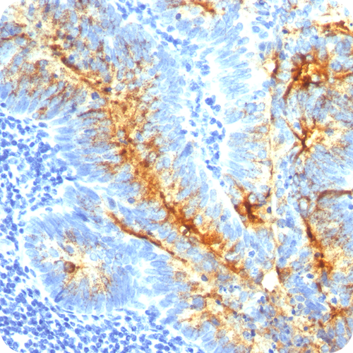 TAG-72 (Tumor-Associated Glycoprotein); Clone CC49 (Concentrate), 0.1mL