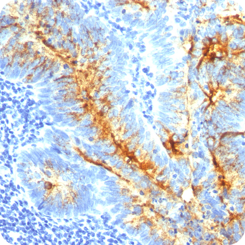TAG-72 (Tumor-Associated Glycoprotein); Clone CC49 (Concentrate), 0.5mL