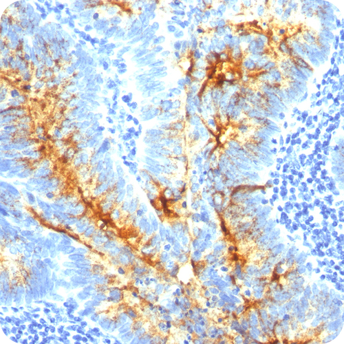 TAG-72 (Tumor-Associated Glycoprotein); Clone CA72/733 (Concentrate), 0.1mL