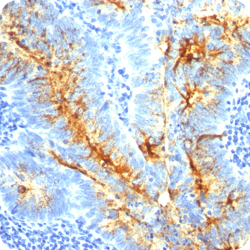TAG-72 (Tumor-Associated Glycoprotein); Clone B72.3 & CA72/733 (Concentrate), 0.5mL