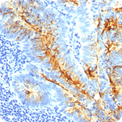 TAG-72 (Tumor-Associated Glycoprotein); Clone B72.3 & CC49 (Concentrate), 0.5mL