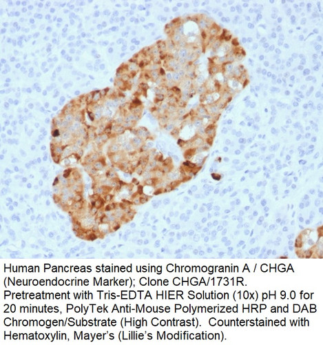 Chromogranin A / CHGA (Neuroendocrine Marker); Clone CHGA/1731R (Concentrate), 0.5mL