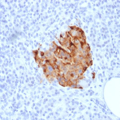 Chromogranin A / CHGA (Neuroendocrine Marker); Clone CHGA/1773R (Concentrate), 1mL