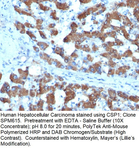 CPS1 / Carbamoyl-Phosphate Synthetase (Hepatocellular Marker); Clone SPM615 (Concentrate), 0.1mL