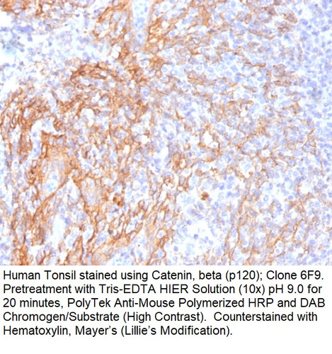 Catenin, beta (p120); Clone 6F9 (Concentrate), 0.1mL