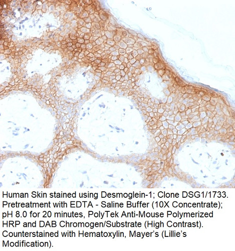Desmoglein-1 (DSG1); Clone DSG1/1733 (Concentrate), 0.1mL